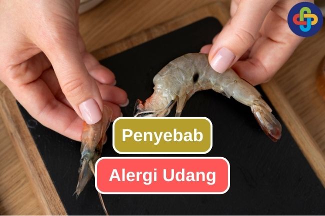 5 Faktor Penyebab Alergi pada Udang